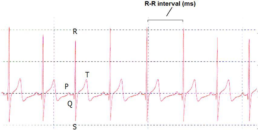 R-R interval srdeční